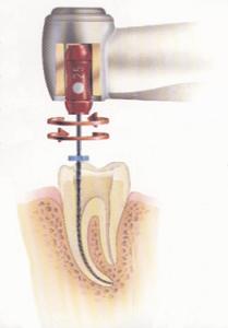 M4 Contra Angle Handpiece
