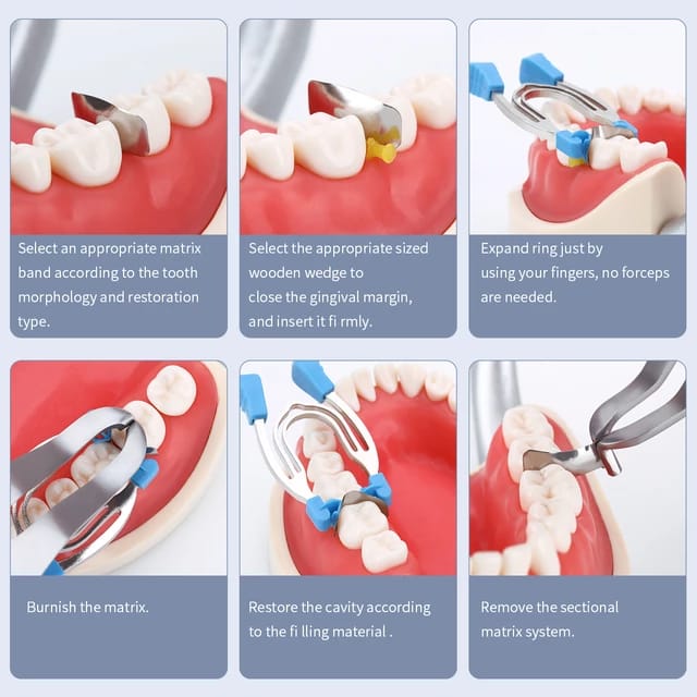 Anyang Yingpai Sectional Clip
