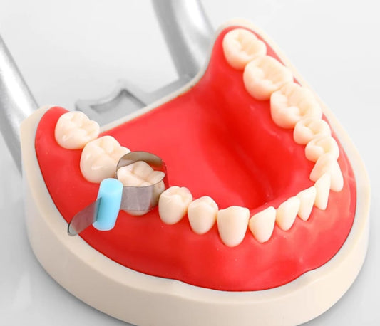 U Dent Retainerless Matrix Band